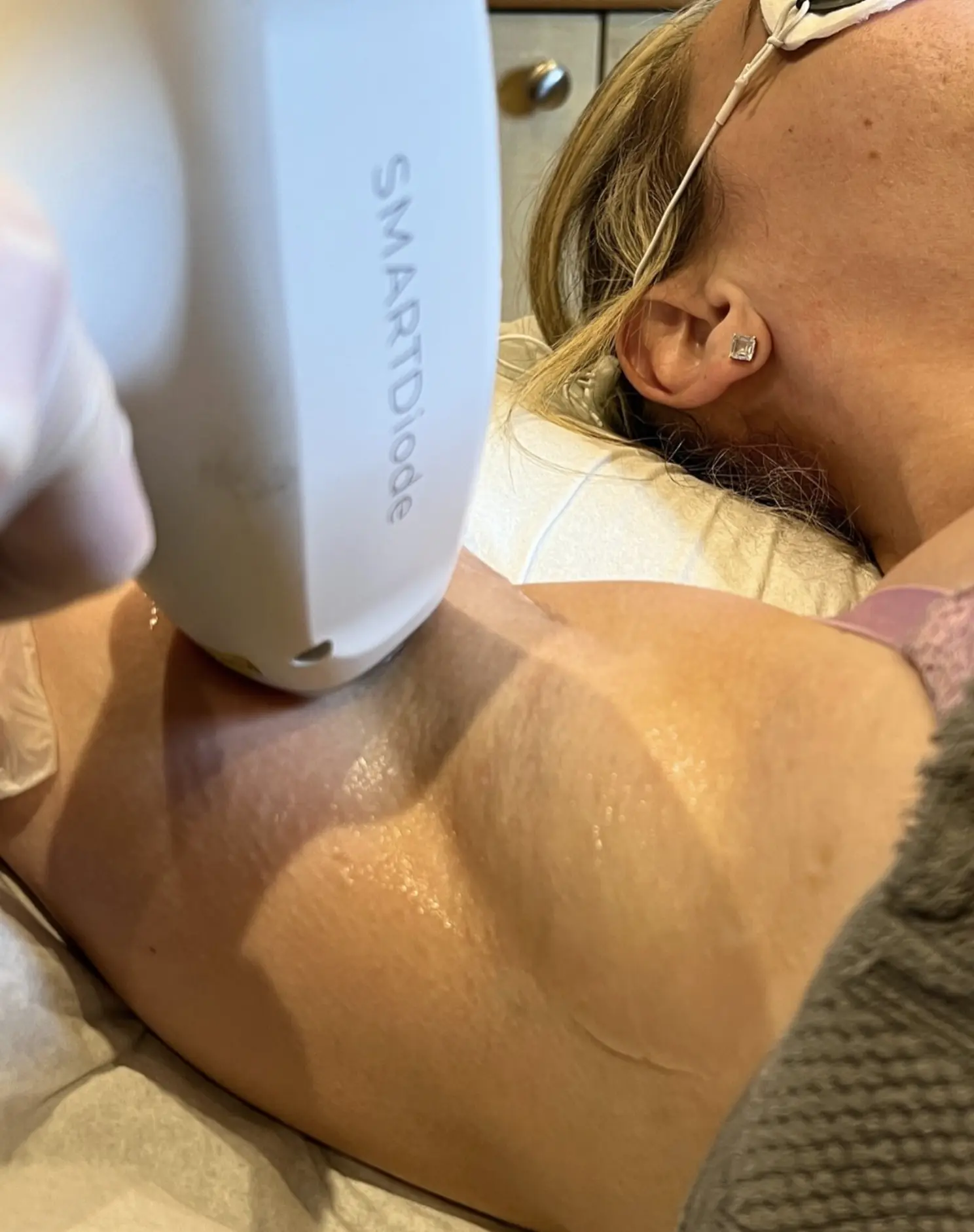 Village Miniature | Which Is The Best Hair Removal Method? braun laser hair removal