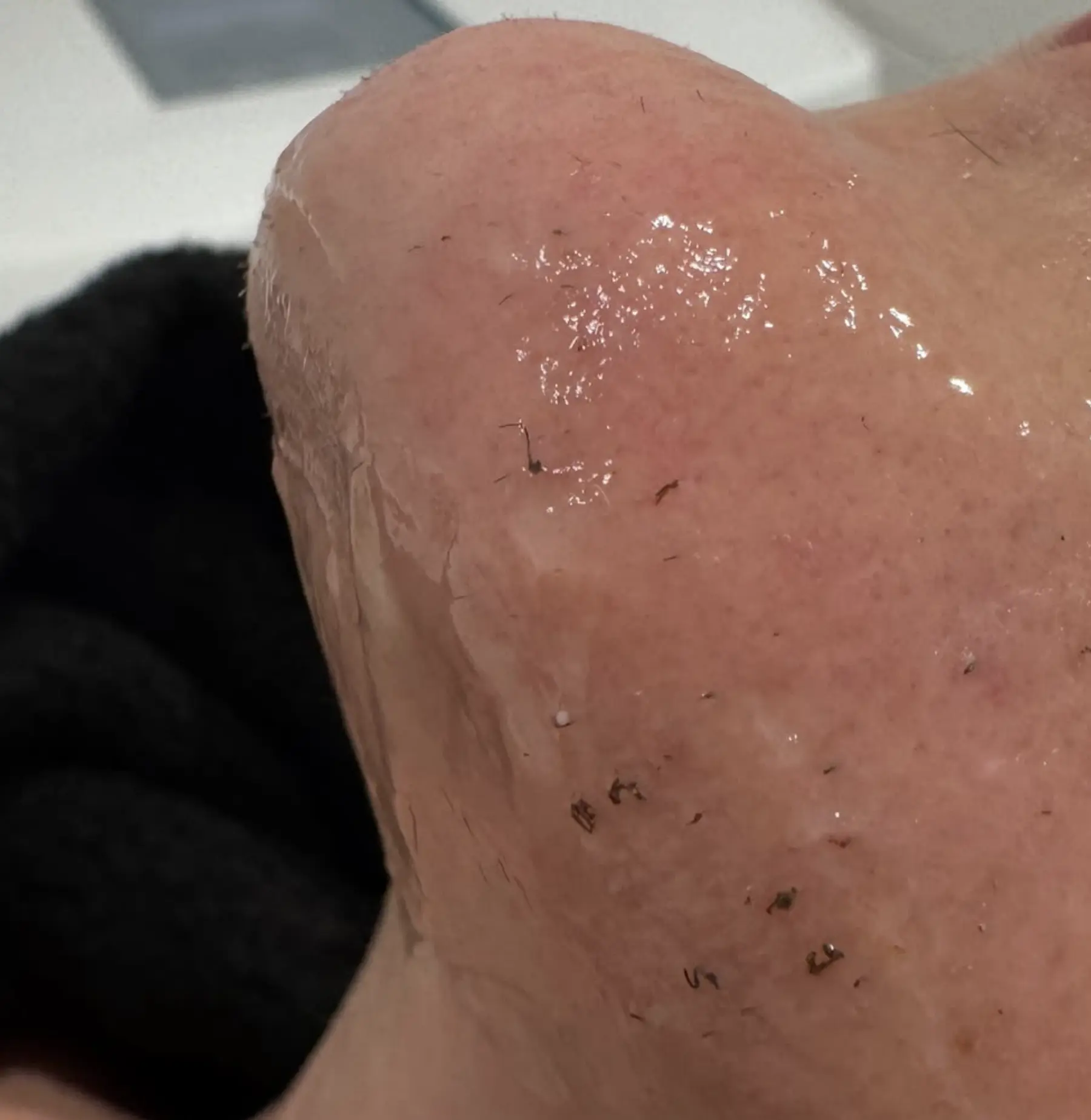 Village Miniature | Which Is The Best Hair Removal Method? laser hair removal melbourne